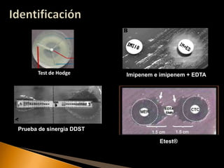 Test de Hodge       Imipenem e imipenem + EDTA




Prueba de sinergia DDST

                                    Etest®
 