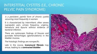 INTERSTITIAL CYSTITIS (I.E., CHRONIC
PELVIC PAIN SYNDROME)
 is a persistent, painful form of chronic cystitis
occurring most frequently in women.
 It is characterized by intermittent, often severe
suprapubic pain, urinary frequency, urgency,
hematuria and dysuria without evidence of
bacterial infection.
 There are cystoscopic findings of fissures and
punctate hemorrhages (glomerulations) in the
bladder mucosa.
 The histologic findings are nonspecific.
 Late in the course, transmural fibrosis may
ensue, leading to a contracted bladder.
 