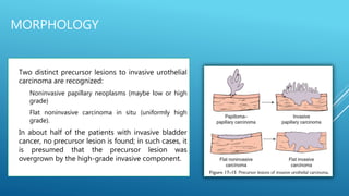 MORPHOLOGY
 Two distinct precursor lesions to invasive urothelial
carcinoma are recognized:
1. Noninvasive papillary neoplasms (maybe low or high
grade)
2. Flat noninvasive carcinoma in situ (uniformly high
grade).
 In about half of the patients with invasive bladder
cancer, no precursor lesion is found; in such cases, it
is presumed that the precursor lesion was
overgrown by the high-grade invasive component.
 