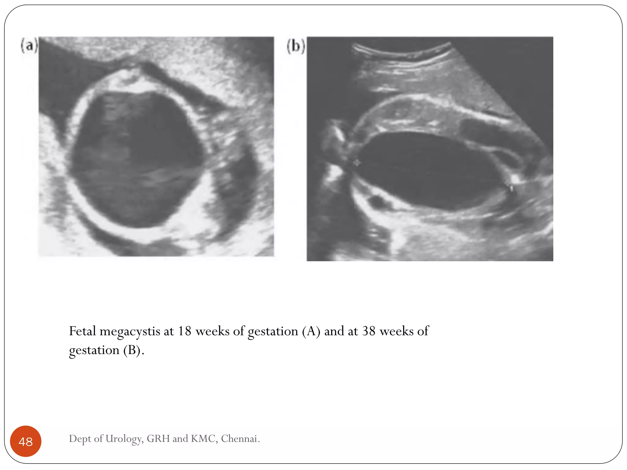 Bladder anatomy & embryology of bladder and urethra-converted | PDF