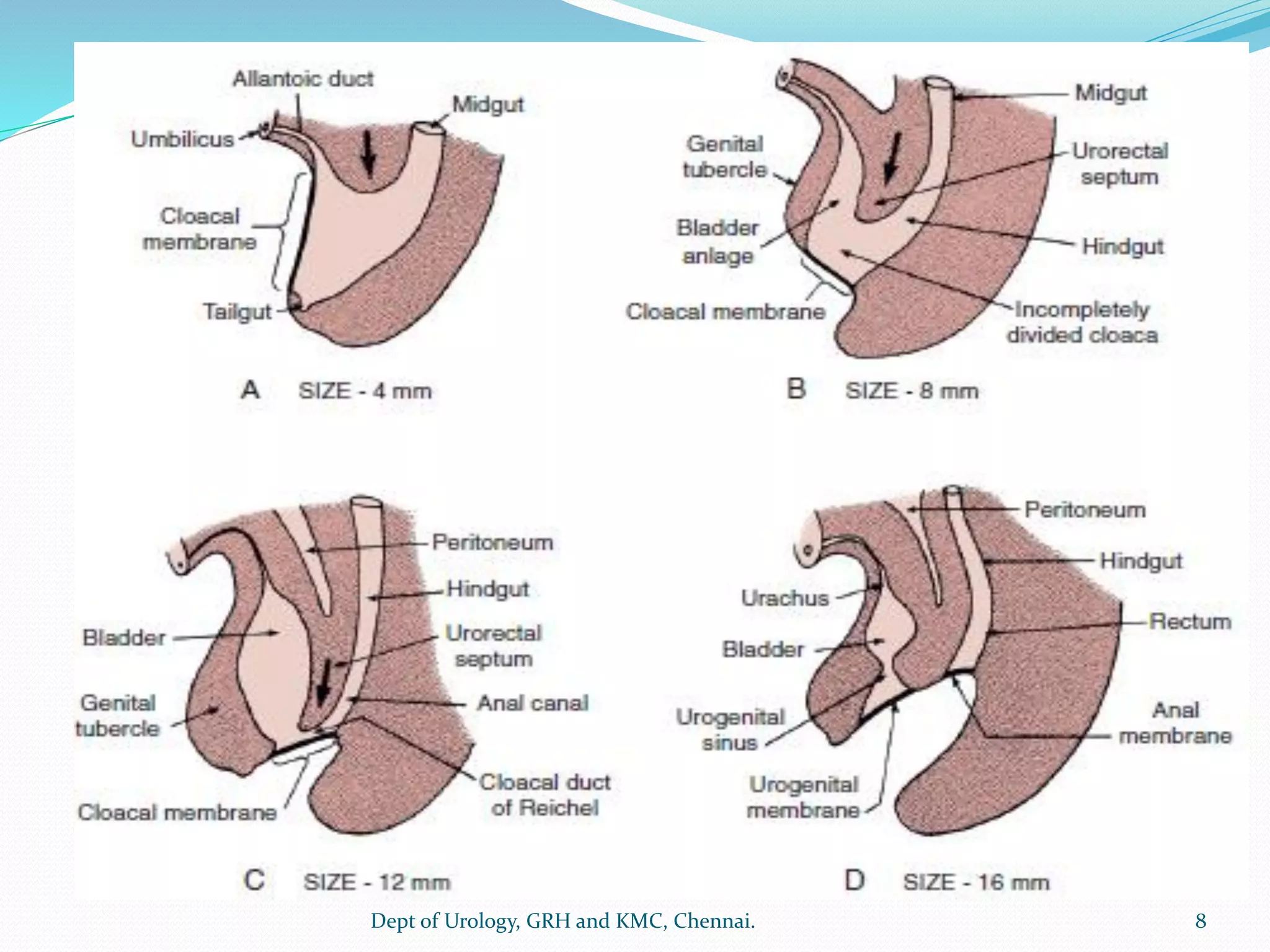 Exstrophy Urinary Bladder anomalies congenital | PDF