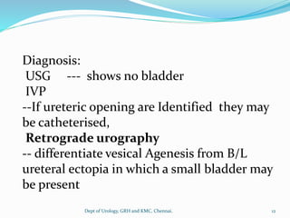 Diagnosis:
USG --- shows no bladder
IVP
--If ureteric opening are Identified they may
be catheterised,
Retrograde urography
-- differentiate vesical Agenesis from B/L
ureteral ectopia in which a small bladder may
be present
12
Dept of Urology, GRH and KMC, Chennai.
 
