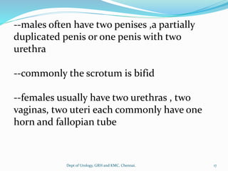 --males often have two penises ,a partially
duplicated penis or one penis with two
urethra
--commonly the scrotum is bifid
--females usually have two urethras , two
vaginas, two uteri each commonly have one
horn and fallopian tube
17
Dept of Urology, GRH and KMC, Chennai.
 