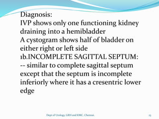 Diagnosis:
IVP shows only one functioning kidney
draining into a hemibladder
A cystogram shows half of bladder on
either right or left side
1b.INCOMPLETE SAGITTAL SEPTUM:
-- similar to complete sagittal septum
except that the septum is incomplete
inferiorly where it has a cresentric lower
edge
23
Dept of Urology, GRH and KMC, Chennai.
 