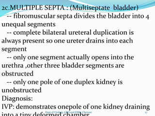 2c.MULTIPLE SEPTA : (Multiseptate bladder)
-- fibromuscular septa divides the bladder into 4
unequal segments
-- complete bilateral ureteral duplication is
always present so one ureter drains into each
segment
-- only one segment actually opens into the
urethra ,other three bladder segments are
obstructed
-- only one pole of one duplex kidney is
unobstructed
Diagnosis:
IVP: demonstrates onepole of one kidney draining
27
Dept of Urology, GRH and KMC, Chennai.
 