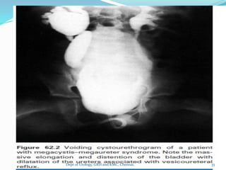 33
Dept of Urology, GRH and KMC, Chennai.
 