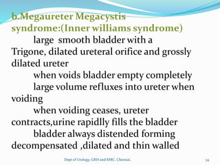 b.Megaureter Megacystis
syndrome:(Inner williams syndrome)
large smooth bladder with a
Trigone, dilated ureteral orifice and grossly
dilated ureter
when voids bladder empty completely
large volume refluxes into ureter when
voiding
when voiding ceases, ureter
contracts,urine rapidlly fills the bladder
bladder always distended forming
decompensated ,dilated and thin walled
34
Dept of Urology, GRH and KMC, Chennai.
 