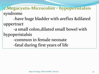 c.Megacystis-Microcolon – hypoperistalsis
syndrome
-have huge bladder with areflux &dilated
uppertract
-a small colon,dilated small bowel with
hypoperistalsis
-common in female neonate
-fatal during first years of life
35
Dept of Urology, GRH and KMC, Chennai.
 