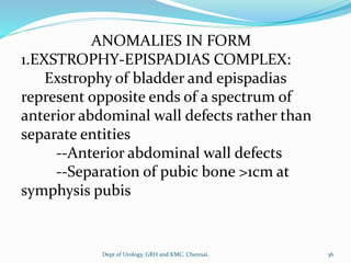 ANOMALIES IN FORM
1.EXSTROPHY-EPISPADIAS COMPLEX:
Exstrophy of bladder and epispadias
represent opposite ends of a spectrum of
anterior abdominal wall defects rather than
separate entities
--Anterior abdominal wall defects
--Separation of pubic bone >1cm at
symphysis pubis
36
Dept of Urology, GRH and KMC, Chennai.
 