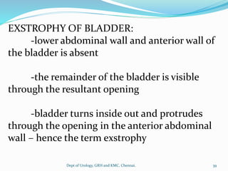 EXSTROPHY OF BLADDER:
-lower abdominal wall and anterior wall of
the bladder is absent
-the remainder of the bladder is visible
through the resultant opening
-bladder turns inside out and protrudes
through the opening in the anterior abdominal
wall – hence the term exstrophy
39
Dept of Urology, GRH and KMC, Chennai.
 