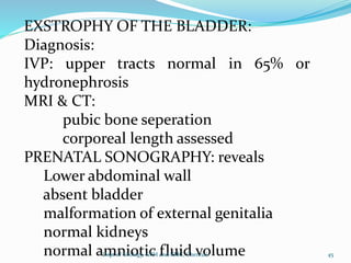 EXSTROPHY OF THE BLADDER:
Diagnosis:
IVP: upper tracts normal in 65% or
hydronephrosis
MRI & CT:
pubic bone seperation
corporeal length assessed
PRENATAL SONOGRAPHY: reveals
Lower abdominal wall
absent bladder
malformation of external genitalia
normal kidneys
normal amniotic fluid volume 45
Dept of Urology, GRH and KMC, Chennai.
 