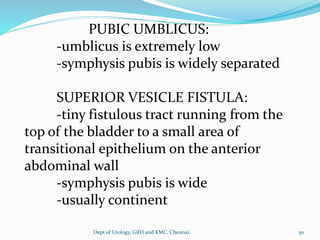 PUBIC UMBLICUS:
-umblicus is extremely low
-symphysis pubis is widely separated
SUPERIOR VESICLE FISTULA:
-tiny fistulous tract running from the
top of the bladder to a small area of
transitional epithelium on the anterior
abdominal wall
-symphysis pubis is wide
-usually continent
50
Dept of Urology, GRH and KMC, Chennai.
 