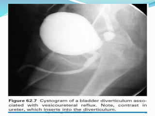 54
Dept of Urology, GRH and KMC, Chennai.
 