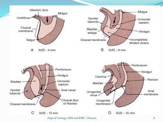 8
Dept of Urology, GRH and KMC, Chennai.
 
