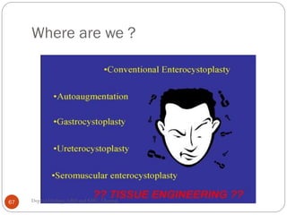 Bladder carcinoma- augmentation cystoplasty complications | PDF