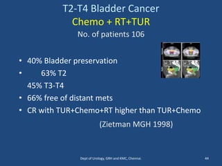 T2-T4 Bladder Cancer
Chemo + RT+TUR
No. of patients 106
• 40% Bladder preservation
• 63% T2
45% T3-T4
• 66% free of distant mets
• CR with TUR+Chemo+RT higher than TUR+Chemo
(Zietman MGH 1998)
44
Dept of Urology, GRH and KMC, Chennai.
 