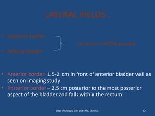 LATERAL FIELDS :
• Superior border
same as in AP/PA portals
• Inferior border
• Anterior border- 1.5-2 cm in front of anterior bladder wall as
seen on imaging study
• Posterior border – 2.5 cm posterior to the most posterior
aspect of the bladder and falls within the rectum
52
Dept of Urology, GRH and KMC, Chennai.
 