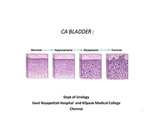 CA BLADDER :
Dept of Urology
Govt Royapettah Hospital and Kilpauk Medical College
Chennai 1
 