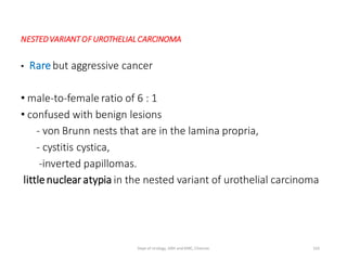 NESTEDVARIANTOFUROTHELIALCARCINOMA
• Rarebut aggressive cancer
• male-to-female ratio of 6 : 1
• confused with benign lesions
- von Brunn nests that are in the lamina propria,
- cystitis cystica,
-inverted papillomas.
littlenuclear atypia in the nested variant of urothelial carcinoma
102
Dept of Urology, GRH and KMC, Chennai.
 