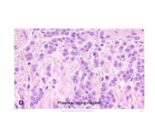 109
Dept of Urology, GRH and KMC, Chennai.
 