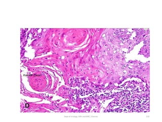 119
Dept of Urology, GRH and KMC, Chennai.
 