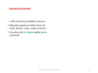 ADENOCARCINOMA
• <2% of primary bladder cancers
• Majority represent Mets from GI
tract, breast, lung , colon primary
• Usually arise in trigoneor in dome
(urachal)
123
Dept of Urology, GRH and KMC, Chennai.
 