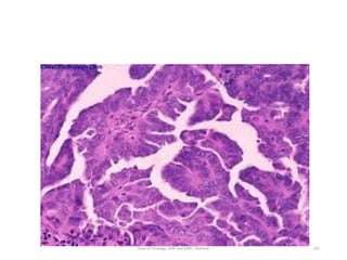 125
Dept of Urology, GRH and KMC, Chennai.
 