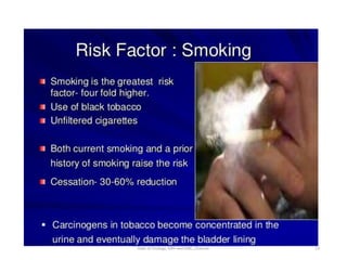 13
Dept of Urology, GRH and KMC, Chennai.
 