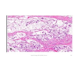 134
Dept of Urology, GRH and KMC, Chennai.
 