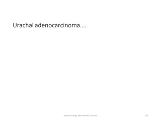 Urachal adenocarcinoma....
135
Dept of Urology, GRH and KMC, Chennai.
 