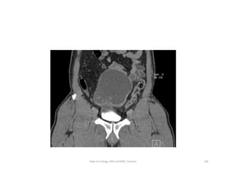 138
Dept of Urology, GRH and KMC, Chennai.
 