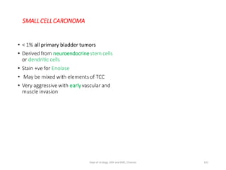 SMALLCELLCARCINOMA
• < 1% all primary bladder tumors
• Derived from neuroendocrinestem cells
or dendritic cells
• Stain +ve for Enolase
• May be mixed with elements of TCC
• Very aggressive with earlyvascular and
muscle invasion
142
Dept of Urology, GRH and KMC, Chennai.
 