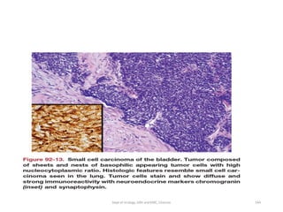 144
Dept of Urology, GRH and KMC, Chennai.
 