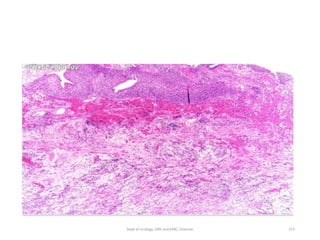 153
Dept of Urology, GRH and KMC, Chennai.
 