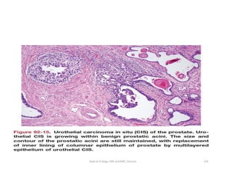 156
Dept of Urology, GRH and KMC, Chennai.
 