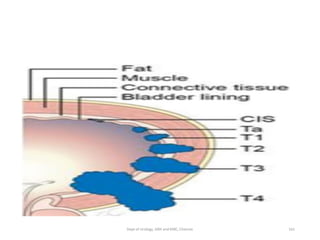 161
Dept of Urology, GRH and KMC, Chennai.
 
