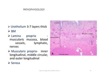 PATHOPHYSIOLOGY
 Urothelium 3-7 layers thick
 BM
 Lamina propria -
muscularis mucosa, blood
vessels, lymphatic,
nerves
 Muscularis propria- inner
longitudinal, middle circular,
and outer longitudinal
 Serosa
23
Dept of Urology, GRH and KMC, Chennai.
 
