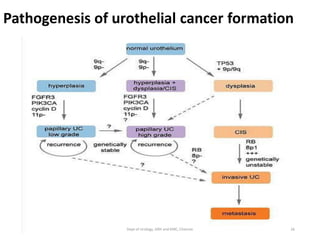 Pathogenesis of urothelial cancer formation
26
Dept of Urology, GRH and KMC, Chennai.
 