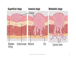 35
Dept of Urology, GRH and KMC, Chennai.
 