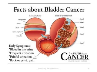 37
Dept of Urology, GRH and KMC, Chennai.
 
