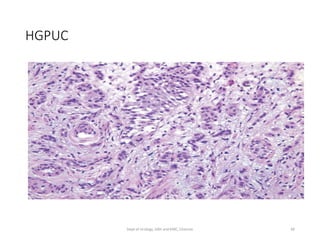 HGPUC
46
Dept of Urology, GRH and KMC, Chennai.
 