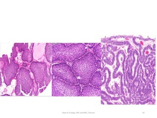 62
Dept of Urology, GRH and KMC, Chennai.
 