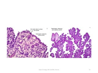 73
Dept of Urology, GRH and KMC, Chennai.
 