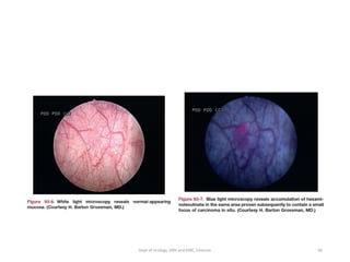 96
Dept of Urology, GRH and KMC, Chennai.
 