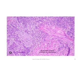 99
Dept of Urology, GRH and KMC, Chennai.
 