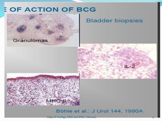 13
Dept of Urology, GRH and KMC, Chennai.
 