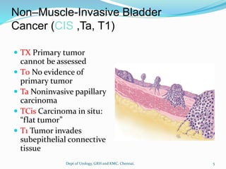 Non–Muscle-Invasive Bladder
Cancer (CIS ,Ta, T1)
 TX Primary tumor
cannot be assessed
 T0 No evidence of
primary tumor
 Ta Noninvasive papillary
carcinoma
 TCis Carcinoma in situ:
“flat tumor”
 T1 Tumor invades
subepithelial connective
tissue
5
Dept of Urology, GRH and KMC, Chennai.
 