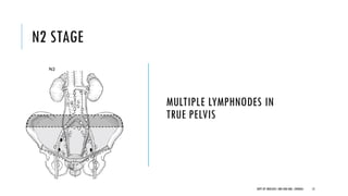 N2 STAGE
MULTIPLE LYMPHNODES IN
TRUE PELVIS
13
DEPT OF UROLOGY, GRH AND KMC, CHENNAI.
 