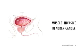 MUSCLE INVASIVE
BLADDER CANCER
3
DEPT OF UROLOGY, GRH AND KMC, CHENNAI.
 