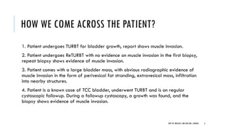 HOW WE COME ACROSS THE PATIENT?
1. Patient undergoes TURBT for bladder growth, report shows muscle invasion.
2. Patient undergoes ReTURBT with no evidence on muscle invasion in the first biopsy,
repeat biopsy shows evidence of muscle invasion.
3. Patient comes with a large bladder mass, with obvious radiographic evidence of
muscle invasion in the form of perivesical fat stranding, extravesical mass, infiltration
into nearby structures.
4. Patient is a known case of TCC bladder, underwent TURBT and is on regular
cystoscopic followup. During a followup cystoscopy, a growth was found, and the
biopsy shows evidence of muscle invasion.
6
DEPT OF UROLOGY, GRH AND KMC, CHENNAI.
 